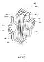 Fig. 45 - Hemodialysis systems and methods