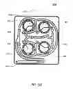 Fig. 68 - Hemodialysis systems and methods