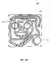 Fig. 77 - Hemodialysis systems and methods