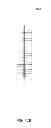 Fig. 94 - Hemodialysis systems and methods