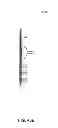 Fig. 99 - Hemodialysis systems and methods