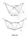 Fig. 18 - Node, apparatus, system and method regarding a frame support for solar mirrors
