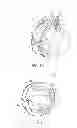 Fig. 03 - Induction Bend Cutting System