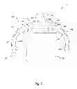 Fig. 03 - Cup Assembly