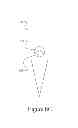 Fig. 14 - NON-CORING REDUCED SHEARING NEEDLE