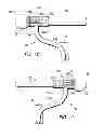 Fig. 08 - Tension window rods