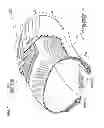 Fig. 02 - Attachment structure