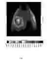 Fig. 22 - Illumination device capable of decreasing shadow of lighting effect