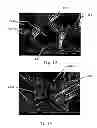 Fig. 08 - Apparatus for Making Polymeric Web Exhibiting a Soft and Silky Tactile Impression