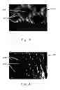 Fig. 09 - Apparatus for Making Polymeric Web Exhibiting a Soft and Silky Tactile Impression