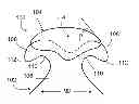 Fig. 01 - Touch fastening