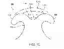 Fig. 03 - Touch fastening
