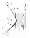 Fig. 11 - Touch fastening
