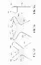 Fig. 13 - Touch fastening