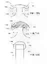 Fig. 14 - Touch fastening
