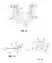 Fig. 06 - PARACHUTE AIRBAG DIFFUSER