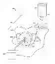 Fig. 01 - EXTERIOR PANEL INTERLOCK