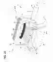 Fig. 19 - Radially embedded permanent magnet rotor having magnet retention features and methods thereof