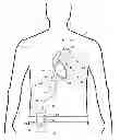 Fig. 01 - Portable controller with integral power source for mechanical circulation support systems