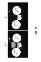 Fig. 19 - Using single continuous pulses for manipulating water and fat signals in magnetic resonance imaging
