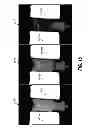 Fig. 20 - Using single continuous pulses for manipulating water and fat signals in magnetic resonance imaging