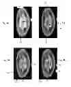 Fig. 05 - Magnetic resonance-based systems for detecting contaminating particles and methods thereof