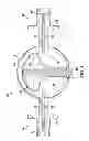 Fig. 02 - Spherical filter