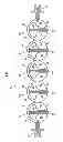 Fig. 04 - Spherical filter
