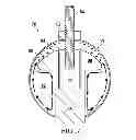 Fig. 07 - Spherical filter