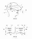 Fig. 02 - Head mountable display