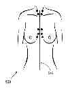 Fig. 01 - Anatomical recognition, orientation and display of an upper torso to assist breast surgery