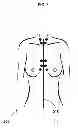 Fig. 06 - Anatomical recognition, orientation and display of an upper torso to assist breast surgery