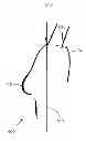 Fig. 07 - Anatomical recognition, orientation and display of an upper torso to assist breast surgery