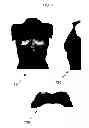 Fig. 08 - Anatomical recognition, orientation and display of an upper torso to assist breast surgery