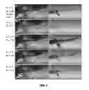 Fig. 08 - INTERACTIVE EXTRACTION OF NEURAL STRUCTURES WITH USER-GUIDED MORPHOLOGICAL DIFFUSION