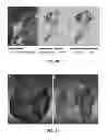 Fig. 09 - INTERACTIVE EXTRACTION OF NEURAL STRUCTURES WITH USER-GUIDED MORPHOLOGICAL DIFFUSION