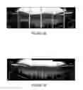 Fig. 07 - Capturing panoramic or semi-panoramic 3D scenes