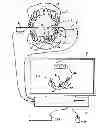 Fig. 01 - Method for the optical three-dimensional measurement of a dental object