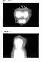 Fig. 18 - Imaging device and imaging method