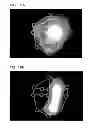 Fig. 19 - Imaging device and imaging method