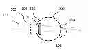 Fig. 01 - Lenses, devices, methods and systems for refractive error