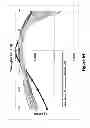 Fig. 65 - Lenses, devices, methods and systems for refractive error