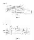 Fig. 14 - Electronic eyeglass frame