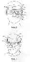 Fig. 02 - Methods and devices for evaluating eyewear fit