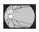 Fig. 01 - Ophthalmologic imaging apparatus, ophthalmologic imaging method, and program