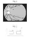 Fig. 03 - Ophthalmologic imaging apparatus, ophthalmologic imaging method, and program