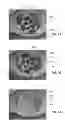 Fig. 08 - Full-eye illumination ocular surface imaging of an ocular tear film for determining tear film thickness and/or providing ocular topography