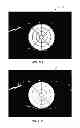 Fig. 22 - Full-eye illumination ocular surface imaging of an ocular tear film for determining tear film thickness and/or providing ocular topography