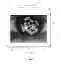 Fig. 28 - Full-eye illumination ocular surface imaging of an ocular tear film for determining tear film thickness and/or providing ocular topography