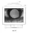Fig. 30 - Full-eye illumination ocular surface imaging of an ocular tear film for determining tear film thickness and/or providing ocular topography